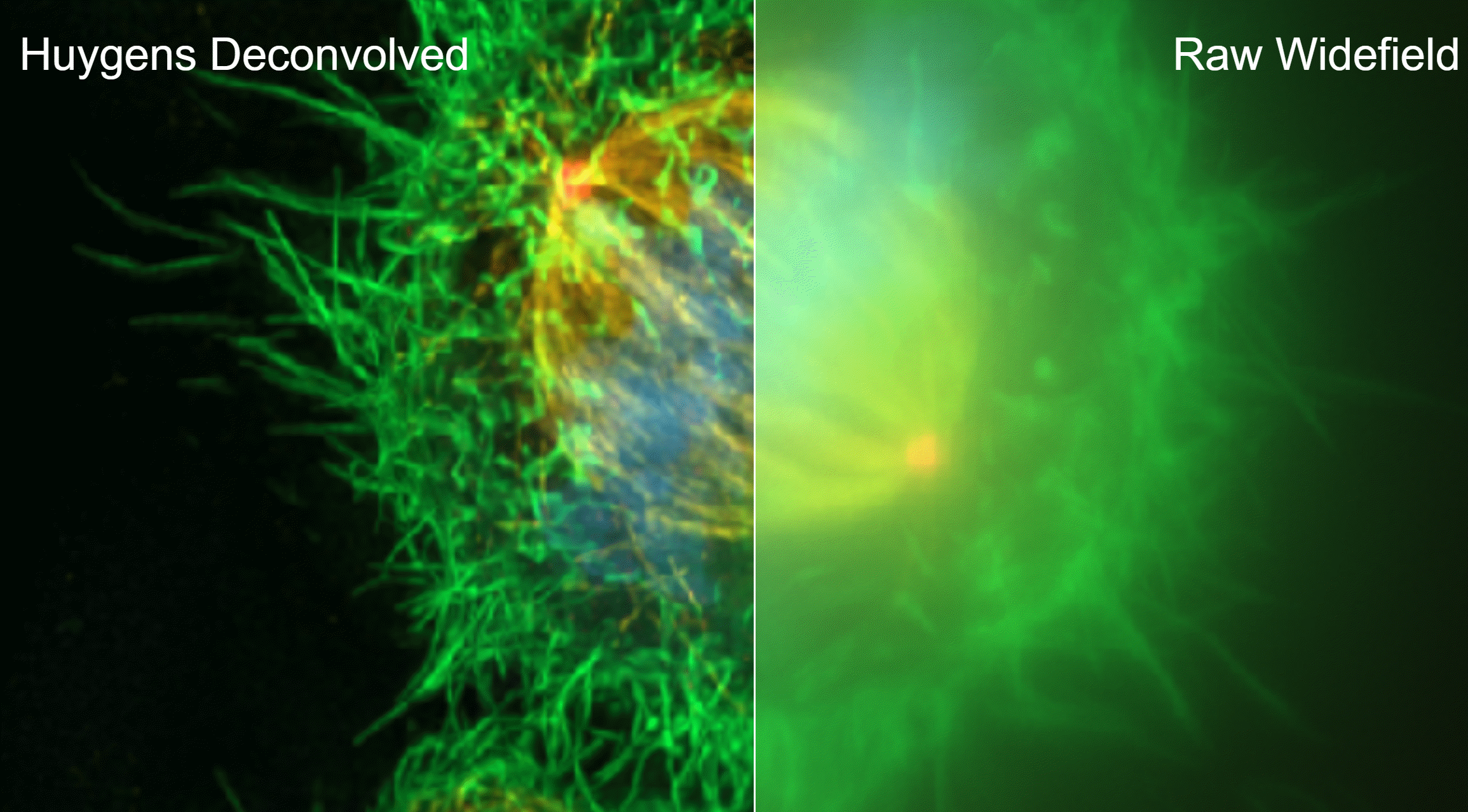 宽场显微镜去卷积分辨率提升效果